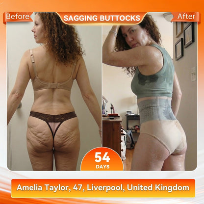 LBMLBM®☀️Moringa & Berberine 4‑In‑1 Micro‑Particle Sculpting & Fat‑Burn Shorts